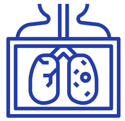 Lung Cancer Screening